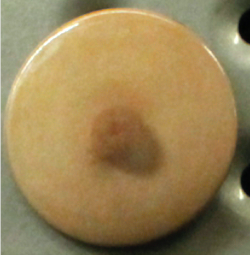 Breast Button